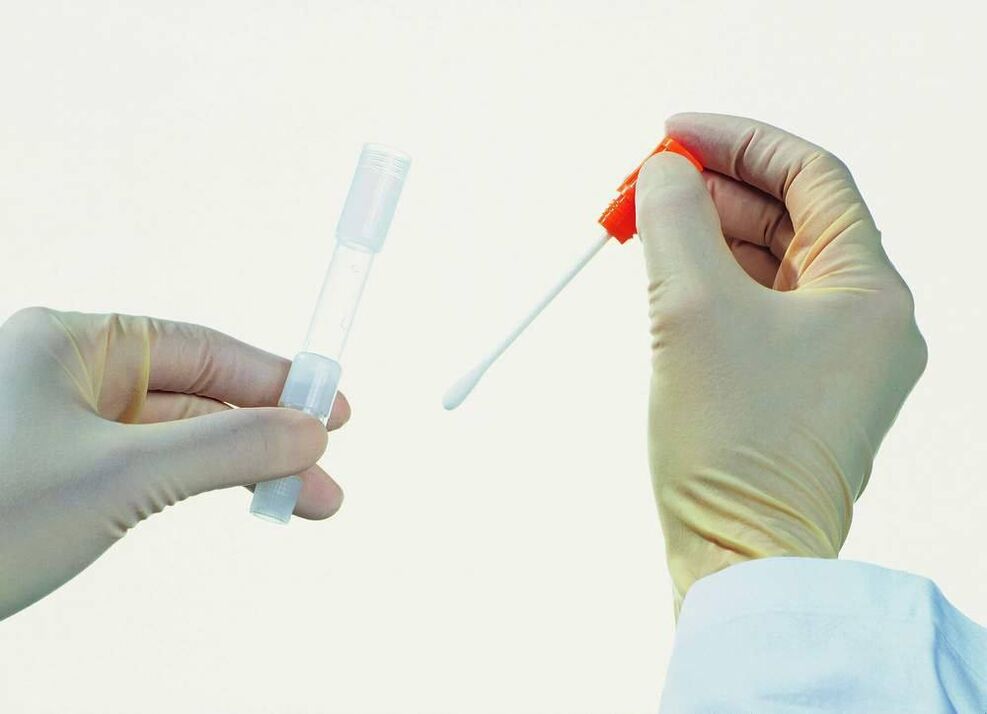 Tesztek gyűjtése a krónikus prosztatagyulladás kimutatására